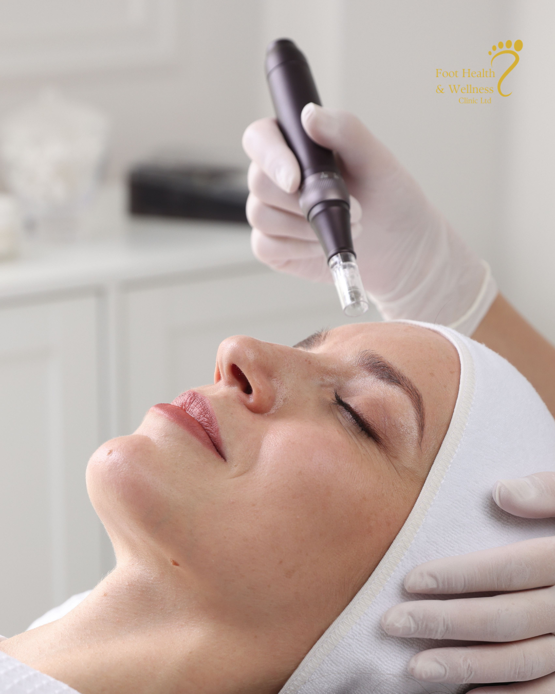 The Benefits of Microneedling for Skin Rejuvenation